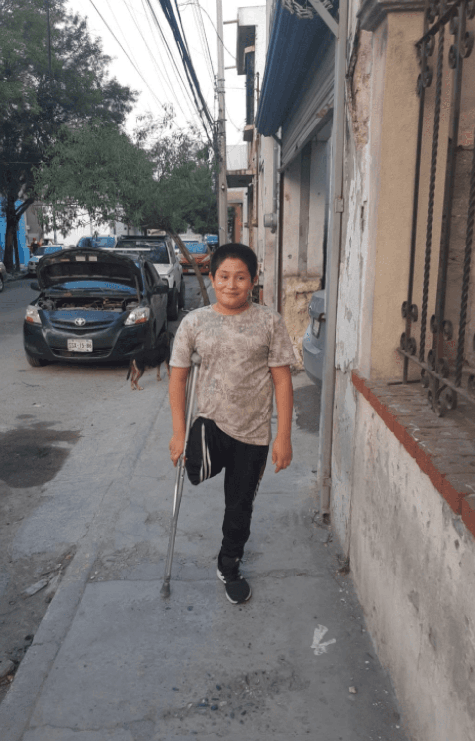 Juan Pablo Buitron Juárez - candidato a prótesis