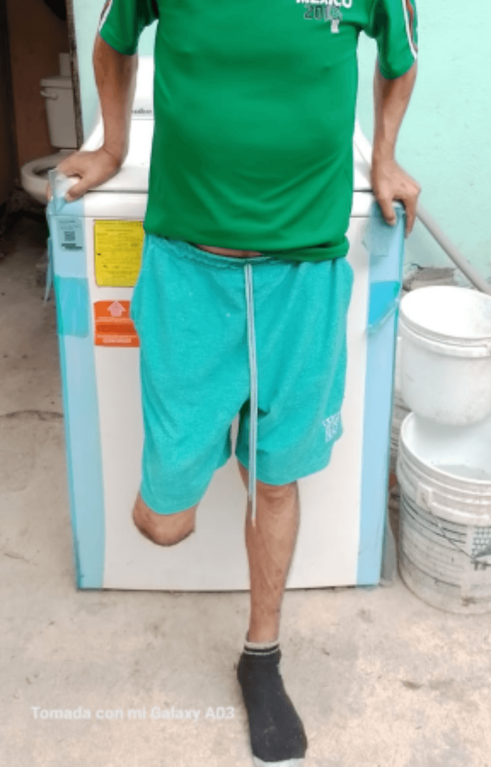 José Juan González Rodríguez - candidato a prótesis